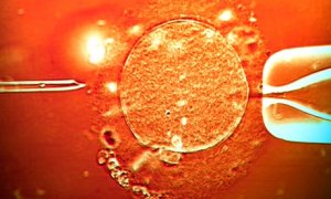 Óvulo sendo fertilizado por meio da Fertilização in Vitro - FIV