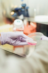 Mão com luva segurando testes ALICE e EMMA que detectam endometrite crônica