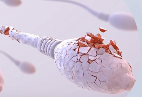 TESTE DE FRAGMENTAÇÃO DO DNA DO ESPERMATOZOIDE