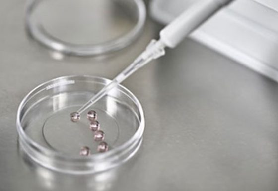 FERTILIZAÇÃO IN VITRO (FIV) CLASSICA/CONVENCIONAL
