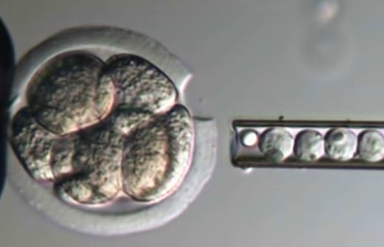 LASER E ASSISTED HATCHING