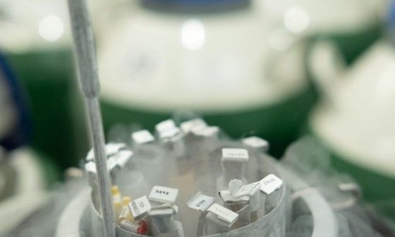 TRANSFERÊNCIA DE EMBRIÃO CONGELADO